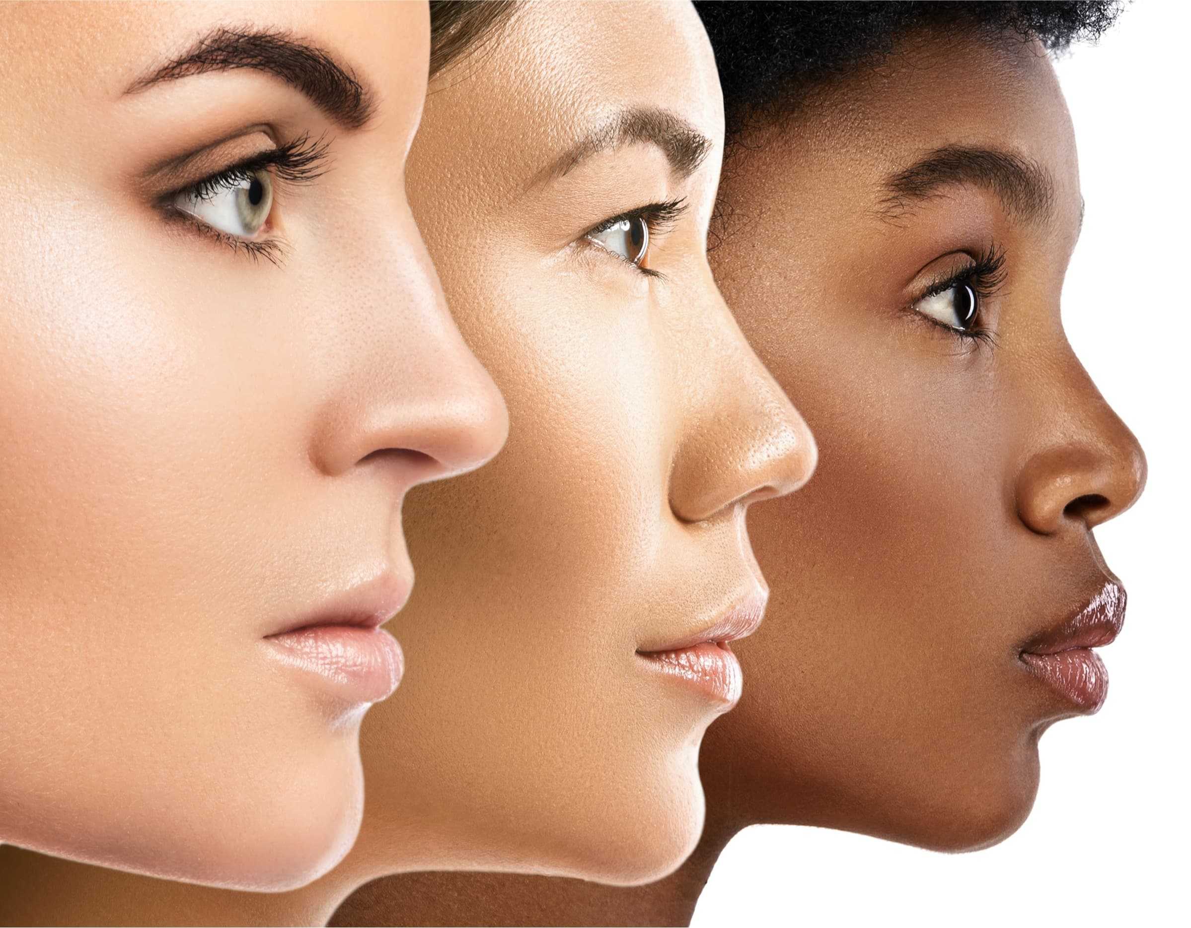 Three women, with faces side on, having had skin treatment at the Skin Emporium Clinic in Clapham, London.